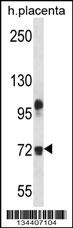 FBLN1 Antibody