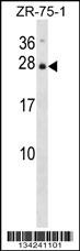 IL25 Antibody