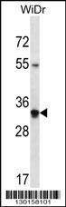 OR2W5 Antibody