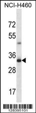 TBC1D21 Antibody