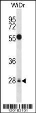 MED6 Antibody