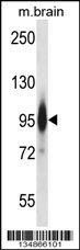 Prkce Antibody