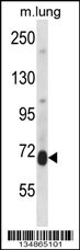 Prkcd Antibody