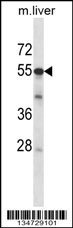 Mouse Adck2 Antibody