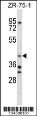AIP Antibody