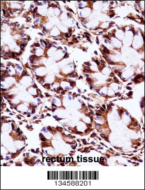 AIP Antibody