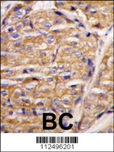 MIPEP Antibody