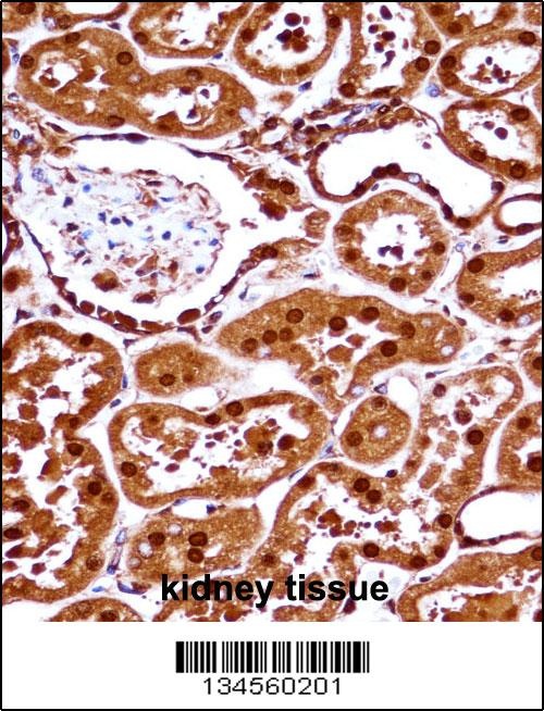 SET Antibody
