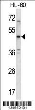 HTR1B Antibody