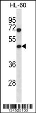 HAT1 Antibody
