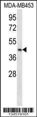 RING1 Antibody