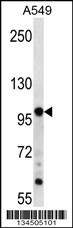 TPX2 Antibody