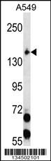 EIF2AK3 Antibody