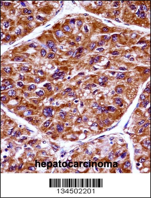 EIF2AK3 Antibody