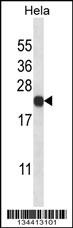 PSMB5 Antibody