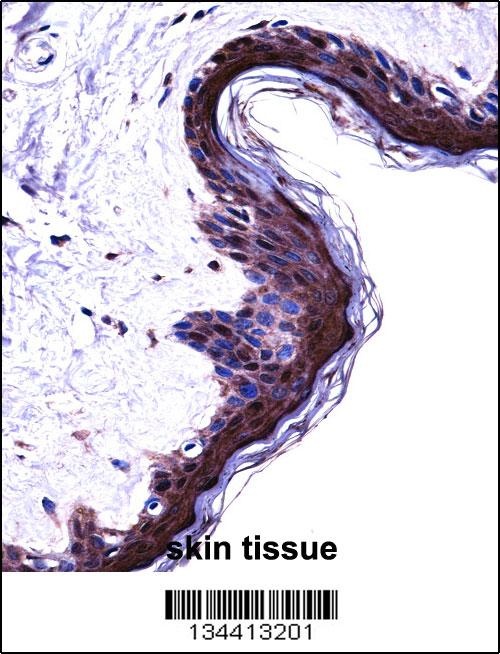 PSMB5 Antibody