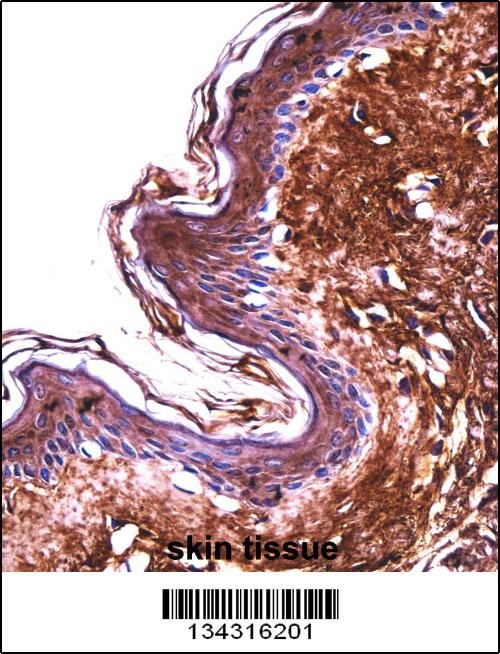 PPT2 Antibody