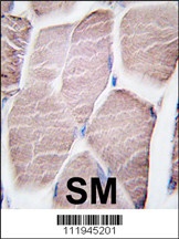 PYGM Antibody