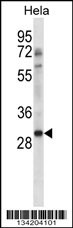 NHEJ1 Antibody