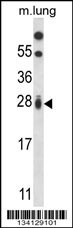 RIT1 Antibody