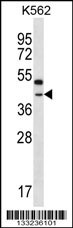 OR6Q1 Antibody