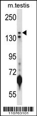 KDM5B Antibody