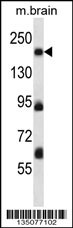 Mouse Map4k4 Antibody