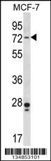 Pak4 Antibody