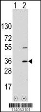 SSR1 Antibody