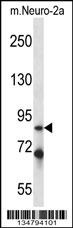 Irak1 Antibody