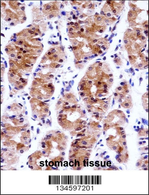 GTF2E1 Antibody