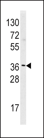 HNMT Antibody