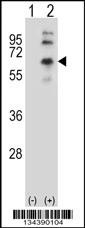 CHRM2 Antibody