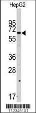SWAP70 Antibody