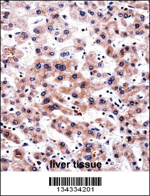 RCAN3 Antibody