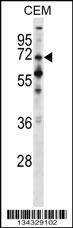 PPEF1 Antibody
