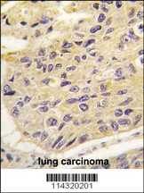 FRAT1 Antibody