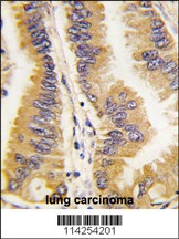 FRAT1 Antibody