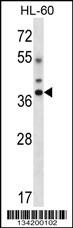 DLX5 Antibody