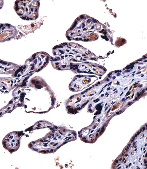IL9R Antibody