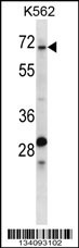TRIP10 Antibody