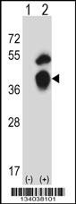 GTF2B Antibody