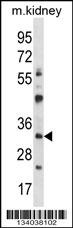 GTF2B Antibody