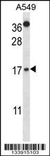 CSTA Antibody
