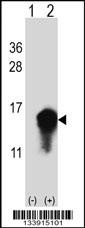 CSTA Antibody