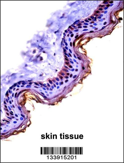 CSTA Antibody