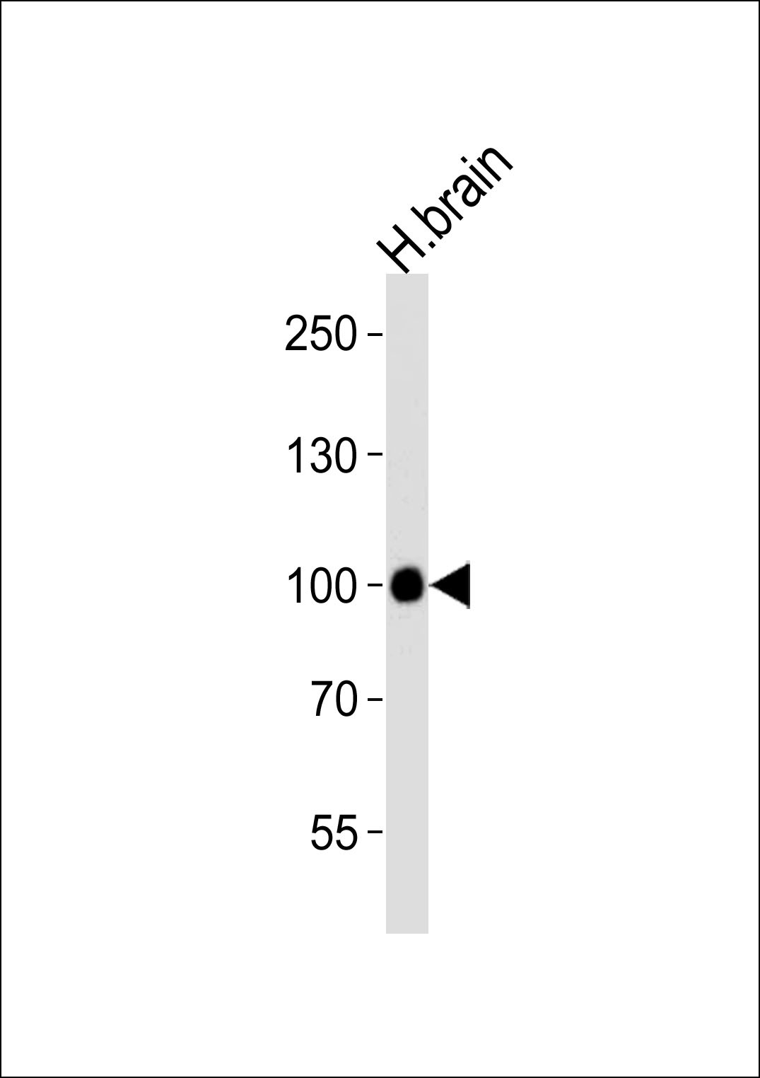 H Cadherin Antibody