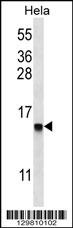 DEFB112 Antibody