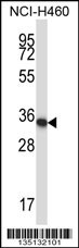 Hoxa11 Antibody