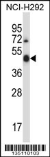 Mouse Ulk3 Antibody